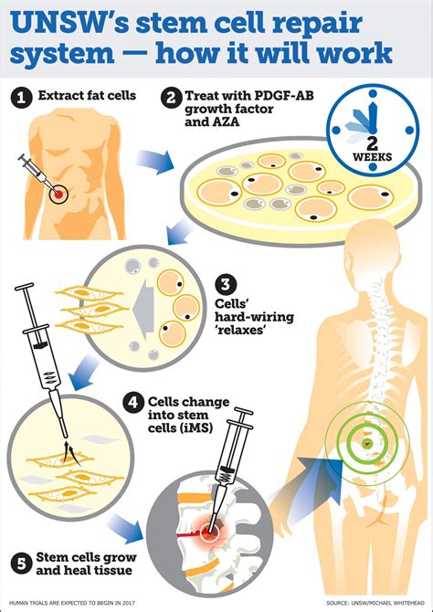 Australian scientists develop 'game changing' | EurekAlert!