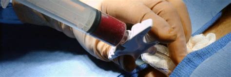 Bone Marrow Biopsy Procedure (with Video) | New Health Advisor