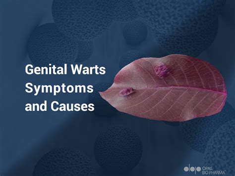 Genital Warts, Symptoms, and Causes - OpalBioPharma