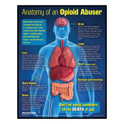 New Opioid Abuse Drug Education 3-D Display | Health Edco