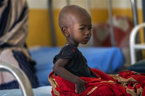 EXPLAINER: A Look At Famine And Its Toll As Somalia At Risk - TrendRadars