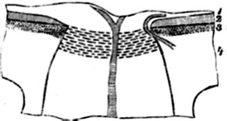 The Cilioretinal Arteries | Ento Key