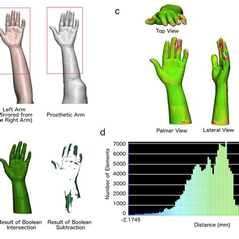 Design and fabrication process for the prosthetic arm. (a) The affected ...