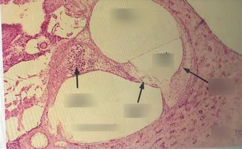 cochlea histology Diagram | Quizlet