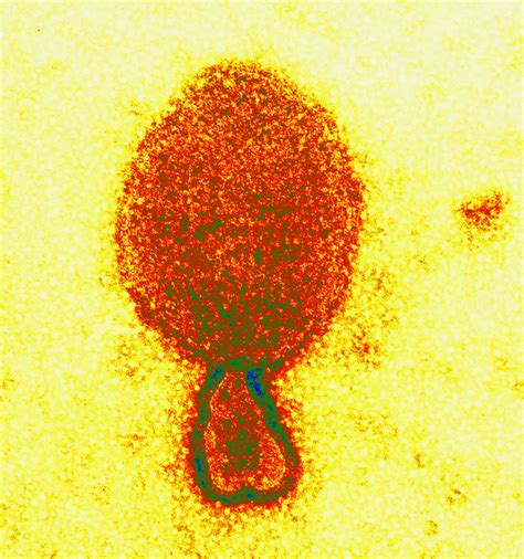 Nipah virus transmission, outbreak, symptoms, diagnosis & treatment