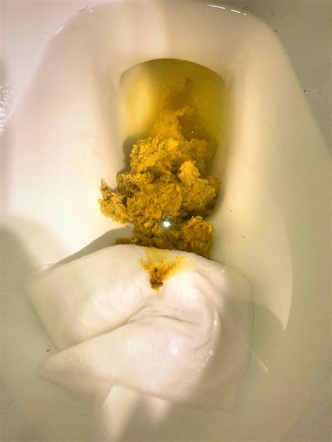 0 Result Images of Why Is My Diarrhea Foamy - PNG Image Collection