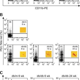 Levels of CD11b+ expression, lipid, and phagocytic activity in ...