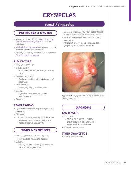 Erysipelas Vs Cellulitis