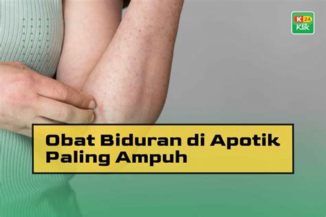 17 Obat Biduran di Apotik Paling Ampuh