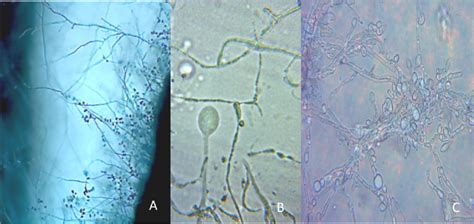 (A-C): Microscopic view of sporangia and Sporangiophore of P. infestans ...