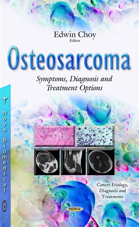 Osteosarcoma: Symptoms, Diagnosis and Treatment Options – Nova Science ...