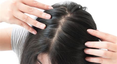 Knowing Your Bald Spot Treatment Options - Toppik Hair Blog