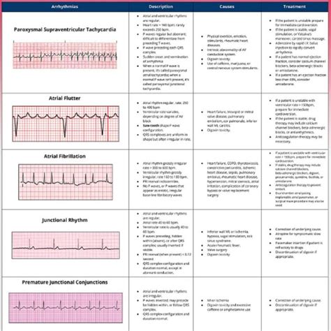 Printable Ekg Interpretation Cheat Sheet