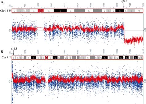 SNP array-based chromosome analysis. a Identification of the deletion ...