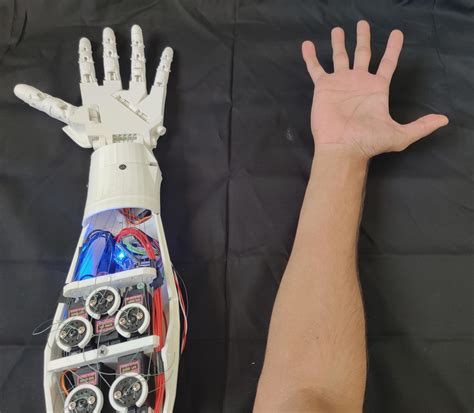 Designing a 3D-printed EMG bionic hand as a low-cost alternative to ...