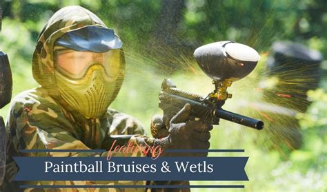 Paintball Bruises and Welts: Treatment & Recovery