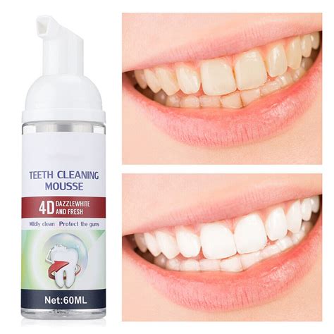 60ml Mint Flavor Teeth Teeth Foam Toothpaste Clean Teeth Removed Stains ...