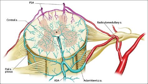 Figure 2: Radicular artery supplying spinal cord