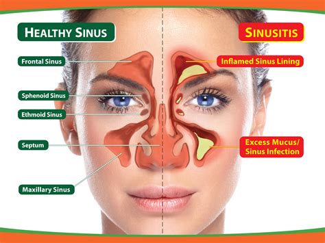 Diagram Of Sinuses And Throat