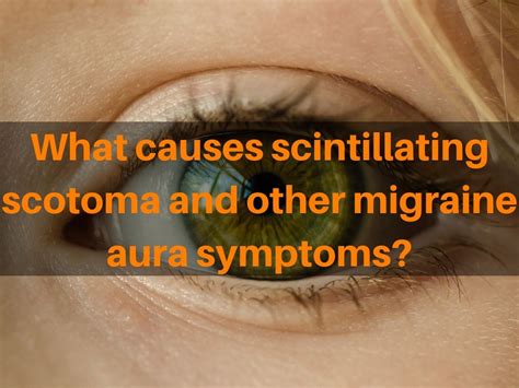 Scintillating scotoma causes with and without migraine headaches ...