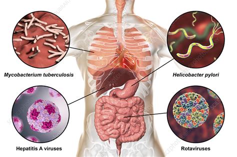 Bacteria that cause human infections, illustration - Stock Image - F023 ...