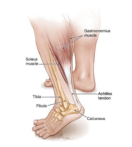 Achilles Tendinopathy; Nyeri Pergelangan Kaki Bagian Belakang