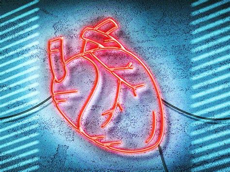 5 common vascular procedures and surgeries