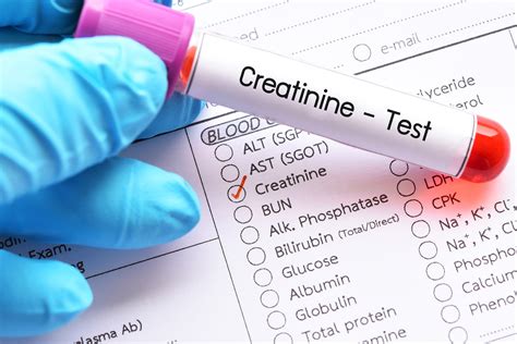 Creatinine Test: High, Low, & Normal Levels - SelfDecode Labs