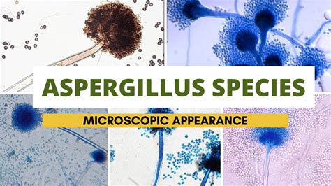 Aspergillus species microscopic appearance | Aspergillus identification ...