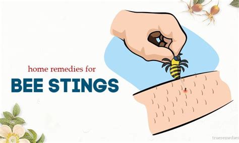 Top 27 Natural Home Remedies For Bee Stings Revealed