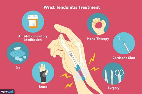 Tendonitis Diagram