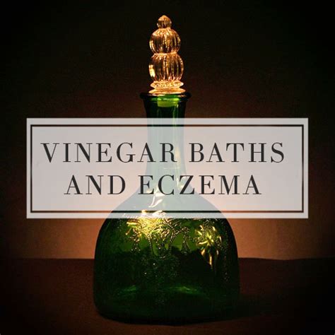 Vinegar baths and Eczema