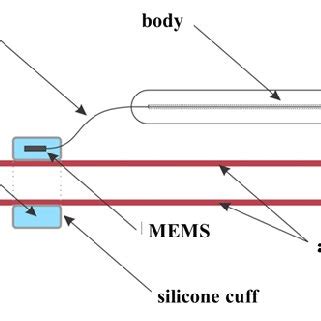 MEMS-device design. Option 1 | Download Scientific Diagram