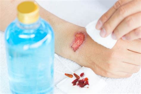 How to Help Your Wounds Heal - The Medication Insider