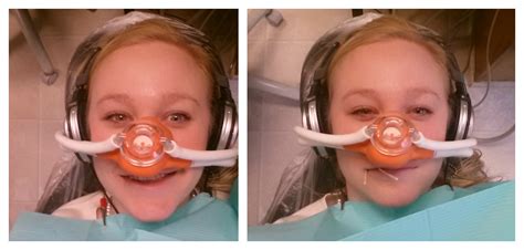 Ruesch Love: MY FIRST EXPERIENCE WITH LAUGHING GAS