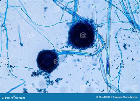 Labelled Aspergillus Niger Under Microscope