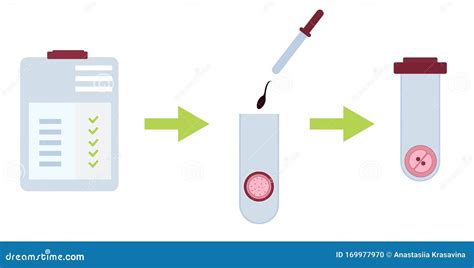 Stages of in Vitro Fertilization Protocol. Flat Stock Illustration ...