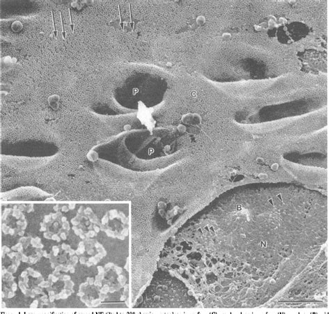 Figure 1 from High resolution scanning electron microscopy of the ...