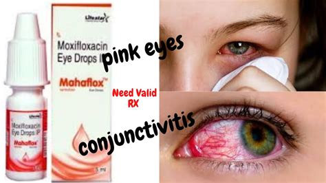 Mahaflox Eye Drops review Conjunctivitis/Pinkeye Symptoms &Treatment ...