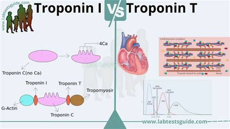 Difference Between Troponin I and Troponin T | Lab Tests Guide