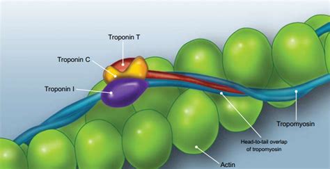 The role of troponin testing in primary care - Best tests December 2009