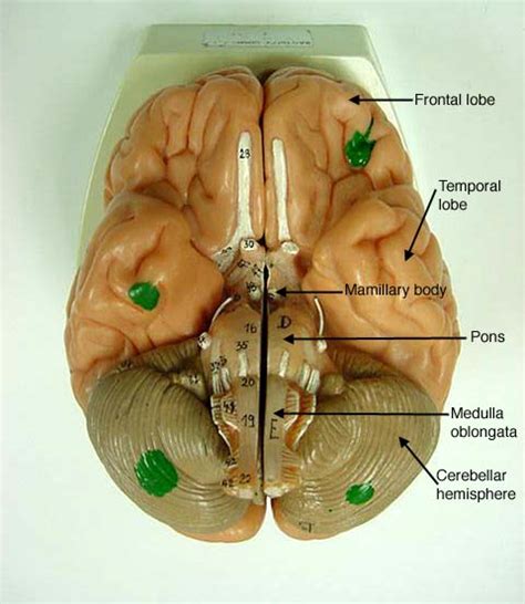 Lobes