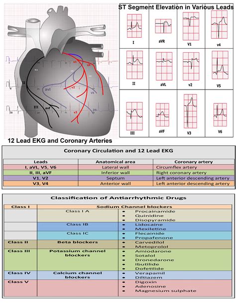 12 Lead Ecg Cheat Sheet Sheet | Images and Photos finder