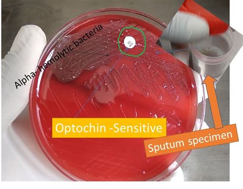 Optochin Sensitivity Test: Principle, Procedure, Result and interpretation