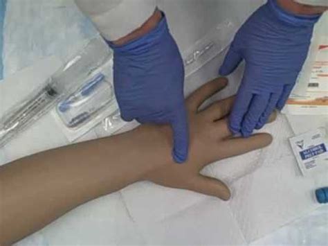 Intravenous (IV) Saline Lock Insertion - YouTube