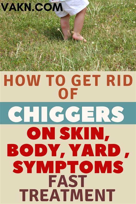 How to get rid of chigger bites fast treatment natural and home ...