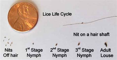 Frequently Asked Lice Questions - Center of Lice Control