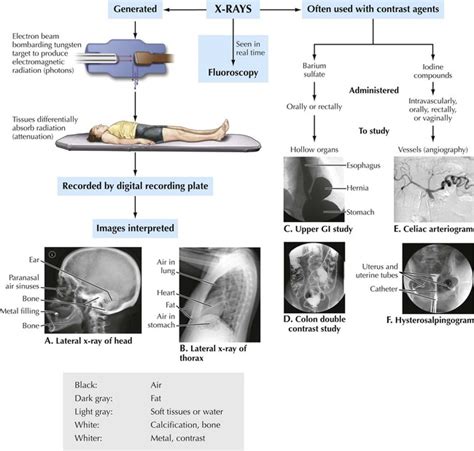 Introduction to Imaging Modalities | Radiology Key