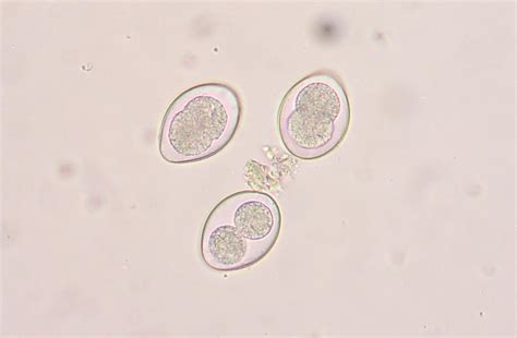 Coccidia - Wikipedia