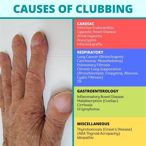 Causes of Clubbing | Pulmonary fibrosis, Graves disease, Inflammatory ...